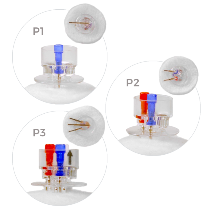 CannuLock™ Catheter Access Buttons, 22G